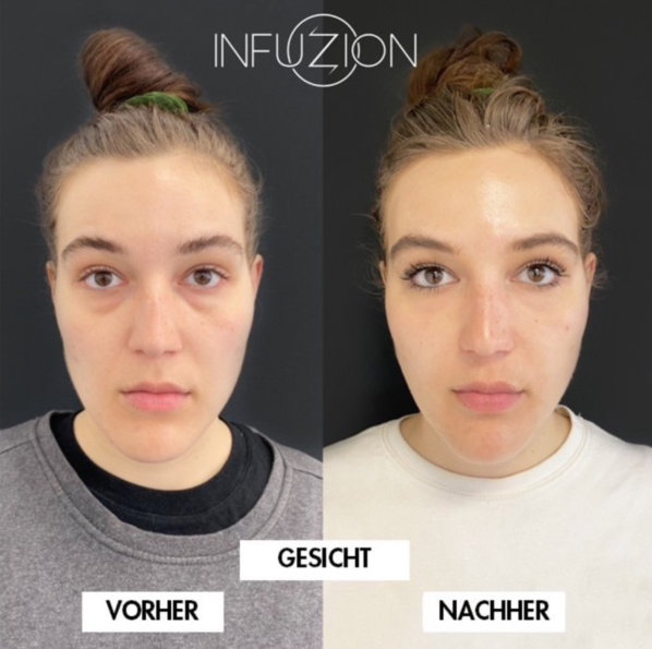 infuzion cover