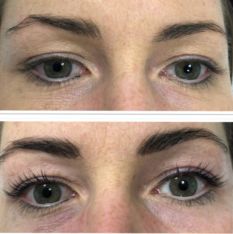 Wimpernlifting